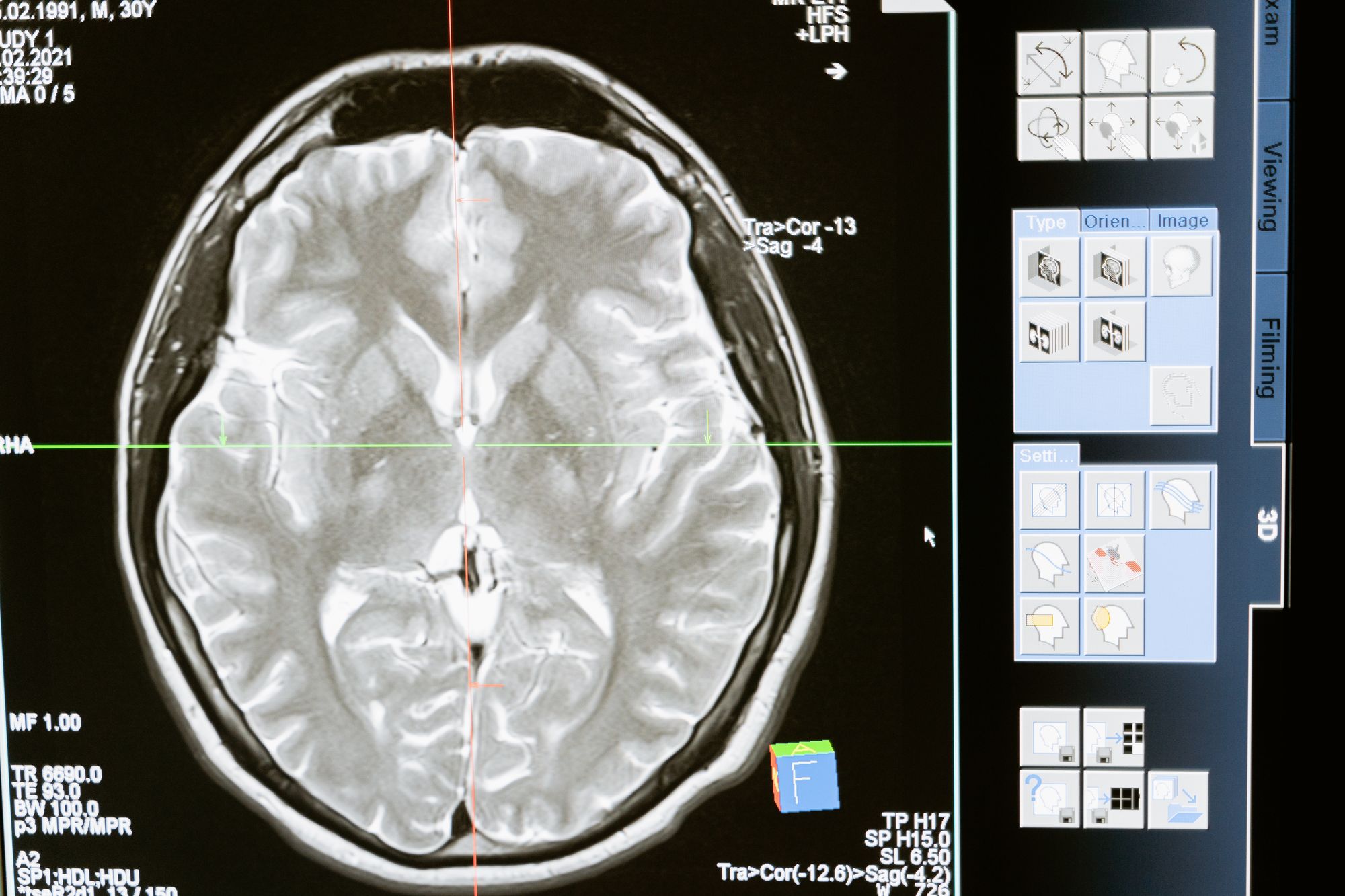 Healthy and balanced brain scan image.  Naan Design.  Naandesign.